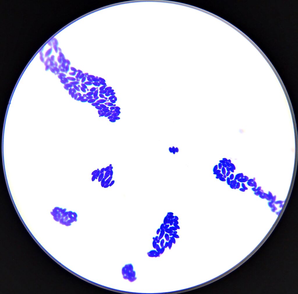 The square image is black with a white center. There are 2 long skinny clusters of purple rods (Lactobacillus). There is 4 smaller cluster at the bottom of the image, and a 3 rods of Lactobacillus cells floating between the 2 long clusters.